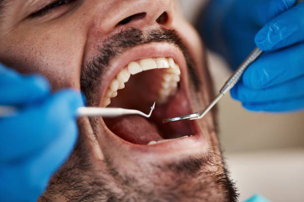 Best Broken or Chipped Tooth Repair in Simsbury Center, CT